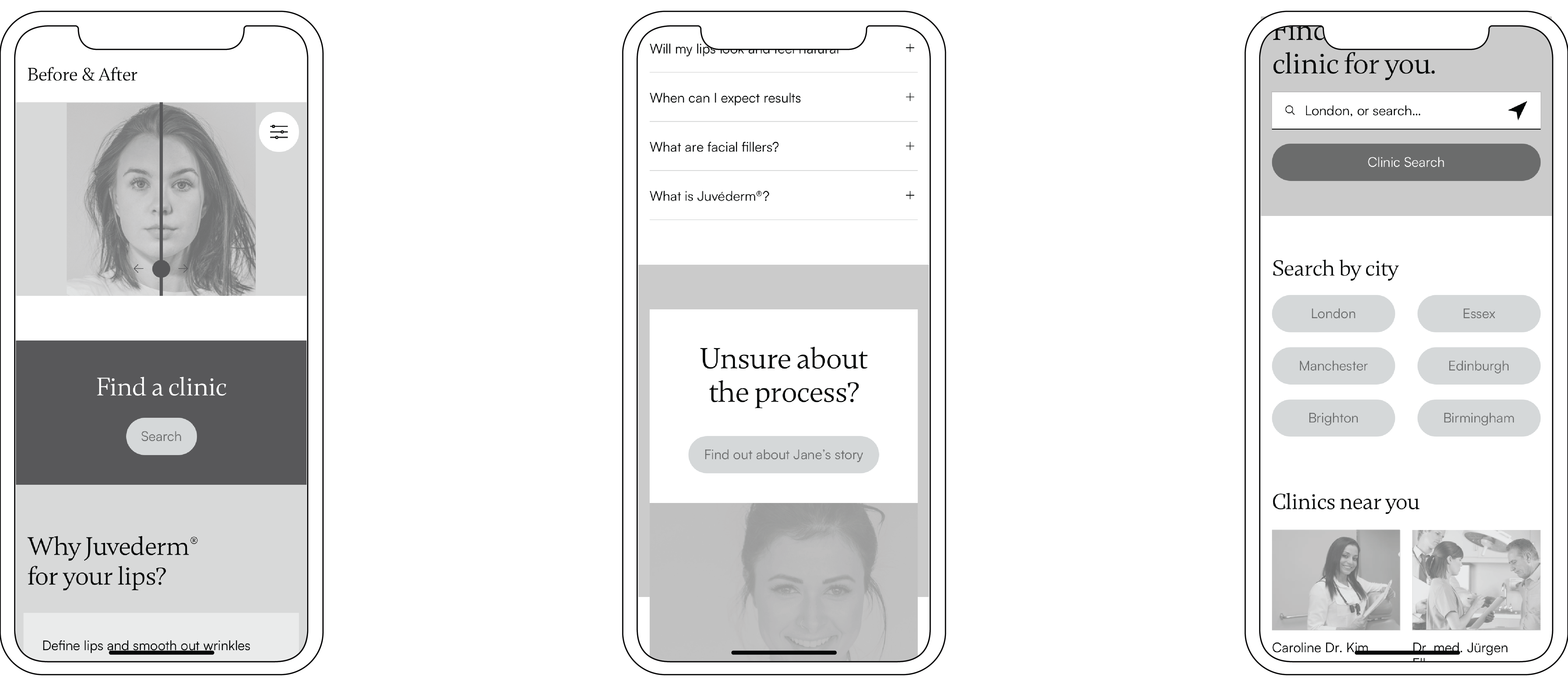 Three wireframes showing designs of personal outcome exploration, social reassurance, procedure details and appointment booking